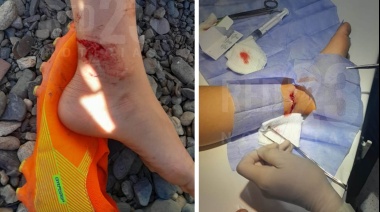Un niño de 9 años resultó gravemente herido tras ser atacado por un perro de 60 kilos