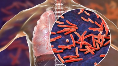 Casos de tuberculosis se disparan un 38 % y tampoco perdonan a Tierra del Fuego