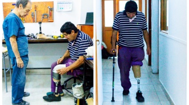 Prótesis a pacientes para mejorar su calidad de vida