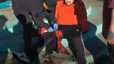 Un hombre herido de bala luego de incidente en la ASOEM