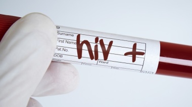 Condenaron a un hombre por contagiar con HIV a su ex pareja