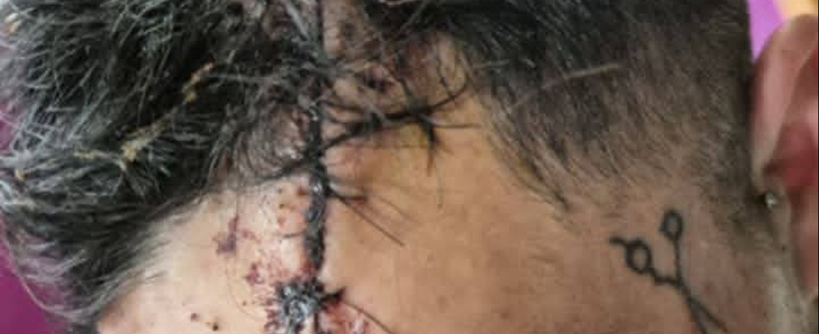 De “viuda negra” a intento de homicidio: el giro en el caso Panichine