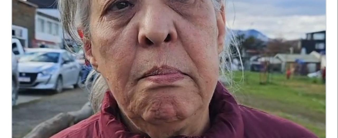 “Si bien respira, ya está muerto”: una vecina de Río Grande denunció abandono total de OSEF