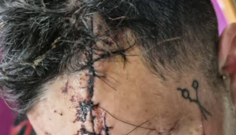 De “viuda negra” a intento de homicidio: el giro en el caso Panichine