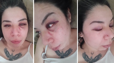 La mujer que fue golpeada en “La Morena” adelantó que iniciará acciones legales