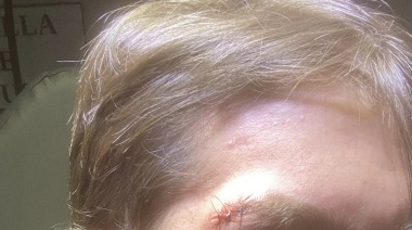 Chofer de Uber fue brutalmente agredido: lo atacaron antes de iniciar el viaje