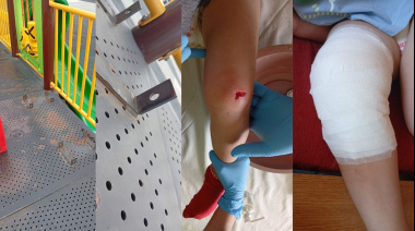 Un juego peligroso: un niño terminó en la guardia por el estado de una plaza de Ushuaia