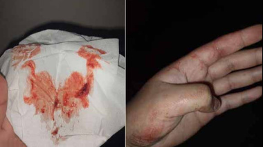 Investigan a funcionario municipal de Ushuaia por una brutal agresión contra un joven