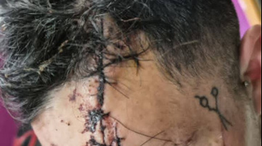 De “viuda negra” a intento de homicidio: el giro en el caso Panichine