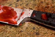 Un joven apareció con un cuchillo clavado en su mano
