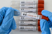 Otra vez COVID: “Frankenstein” la variante que preocupa
