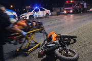 Le amputaron la pierna tras brutal choque al motociclista y permanece internado en terapia intensiva