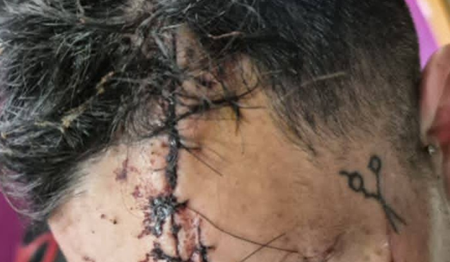 De “viuda negra” a intento de homicidio: el giro en el caso Panichine